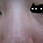 언니들 여드름피부 <b>제품</b> 추천좀해줘용 ㅠㅠ