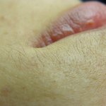 입술 <b>각질</b>때문에 너무 고민인 여자입니다.