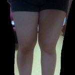 [사진有] 다리심각해요ㅠㅠ너무굵어요,,