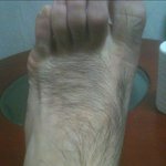 사진有) <b>발등</b>에 나보다 털 많은 사람 있나요?