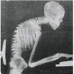 컴퓨터 오래하면 나타나는 증상들