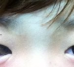 울면 <b>눈밑</b>이 부어요ㅠㅠㅠㅠ(사진有)