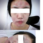 마임화장품 <b>수분</b>크림사용후