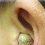 청각 장애인인데....지하철에서 봉변을 당했어요...