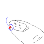 모기 물리면 곤란한 부분 <b>best</b>7