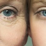 ((눈가주름정복))눈가주름 없애고 탄력을 불어넣자! 눈가주름이제 Good <b>bye</b>