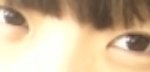 눈좀봐주세요
