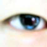 ★★★사진有)<b>비루</b>한 나의 눈~쌍수?★★★