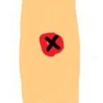 ★★★★모기물렸을떄공감99.87654★★★★