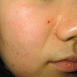 일주일만에 피부좋아지는 방법