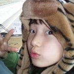 수지 <b>성형</b>전 과거