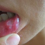 ★★★알보칠, 들어보셨습니까?★★★(+제목수정)