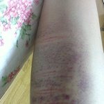 (사진)이정도로 맞으면 학대 아닌가요?