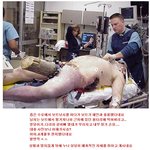 잉여킹의 열아홉번째 이야기. 사고로 <b>통나무</b> 관통