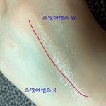 여름철 뾰루지? 트러블? <b>스팟</b>에센스에 놀라운 위엄