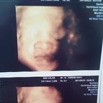 ★19살고등학생 애아빠입니다!(출산임박전<b>예기</b>)사진有★★★