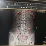 ★★+수정)사진有 관장하길래,.....ㅋ나도해봤거든