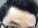 <b>이마</b> 넓은 남자는 구리냐