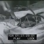 영화 'x파일'에 나왔던 머리이식