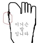 굳은살 미쳐버리겠어