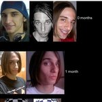 [사진有]  <b>성전환</b>수술자 변화 과정  ★★★★