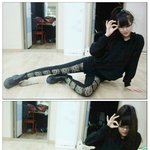 달샤벳 수빈,  입술<b>부상</b> ‘여덟바늘 꿰매' 컴백 활동 비상