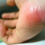 사진有)공감 손목비교해보세요