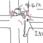 제 동생이 오토바이 타다가 사고가 났습니다.