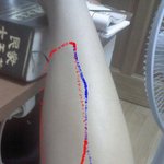 (<b>사진</b>추가)언니들..<b>다리</b>에 이런근육어떻게하죠? (<b>다리사진</b>있어요)...