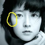 이곳이 옆<b>광대</b> 인가요???