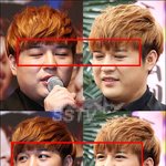 <b>신동</b>, 쌍꺼풀 시술!