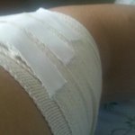 ★★클럽서 맥주병으로 난도질을 당하고 범인이 도주하였습니다..★★...