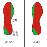 운동하기전에 발 모양부터 체크하세요~!