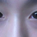 나 쌍수할까봐 어떤지봐죠 사진有