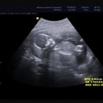 우리아들 자랑하고 싶어요+223