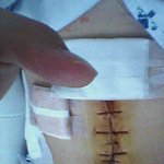 ▒▒▒☞내아들 췌장,비장을 돌려줘!!!▒▒▒