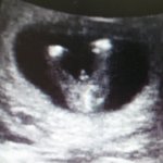 <b>성별</b> 좀 봐주세요.. 12+4