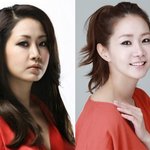 신은경 <b>양악</b>수술 대박!!