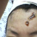 요즘대학병원에서는 수술이 게임? 사고야? 원래그래~