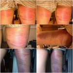 동아리 선배들의 후배에 대한 관행적인 탈퇴의식(집단 폭행)