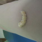 ★★★21살 이빨대신 <b>틀니</b>끼고 살아가는중....웃프다.. ★★★