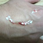 추석날 <b>앞집</b> 사람들한테 구타당했어요(사진有)