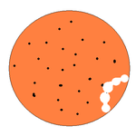 2탄)★★★21살 이빨대신 틀니끼고 살아가는중....웃프다.. ★★★