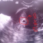 나 남잔데 진심으로 애기 낳고 싶음....