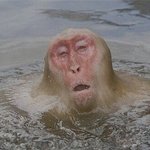 염산에 빠진 사람 초<b>충격</b>   <b>심장</b>약한분은  클릭금지요