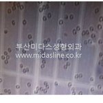 줄기세포가슴성형 1편 - 줄기세포 및 줄기세포가슴성형 이야기 (<b>HOT</b>)