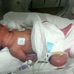 23살 요절복통 출산후기 (29주 조산 ㅠㅠ)