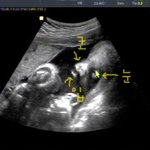 (출산후기 사진 有)10달동안의 기다림 그리고 , 만남