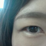 나 뒷트임, 쌍꺼풀, 눈매교정하려구~ 사진좀 봐줘요!
