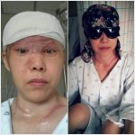 사고로 머리카락을 다 잃은 엄마에게 희망을 !!!